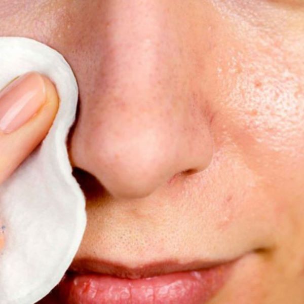 5 Easy DIY Masks for Blackheads and Clogged Pores